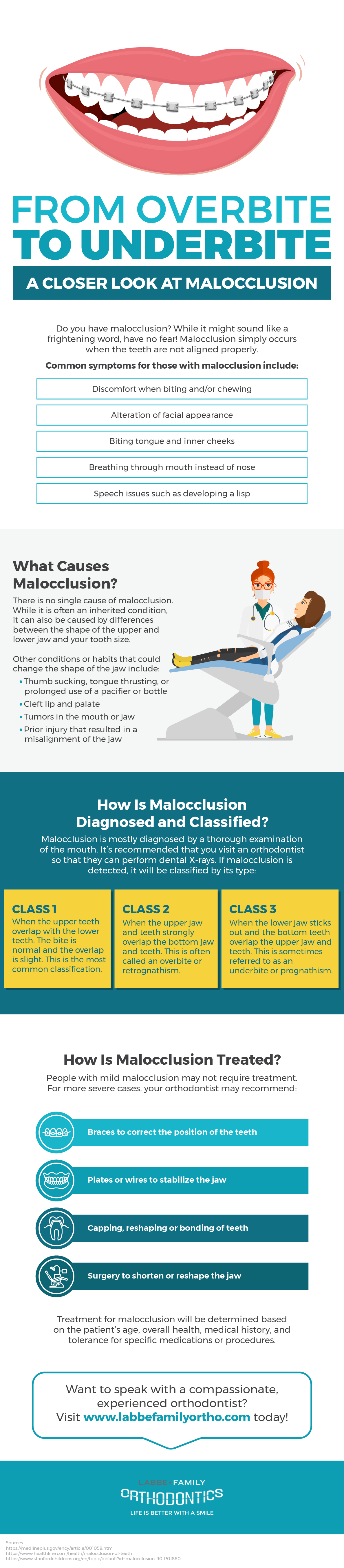 From Overbite to Underbite – A Closer Look at Malocclusion