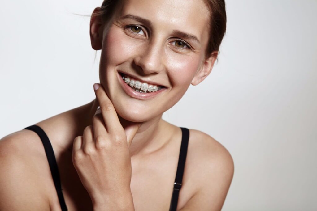 Woman wearing braces and smiling for a picture while posing with her hand on her chin