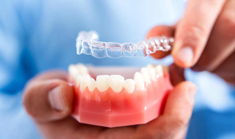 Orthodontist fitting an Invisalign aligner onto the bottom teeth of a hard plastic dental model